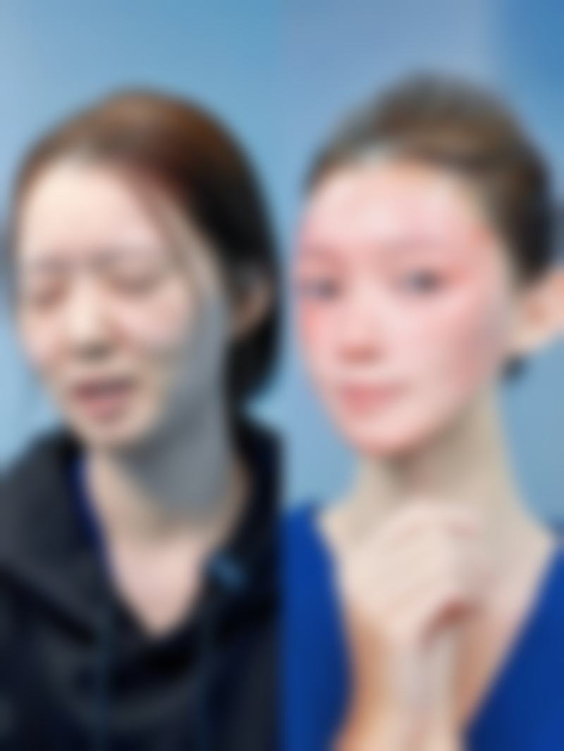 毛发种植一般需要多少钱贵不贵