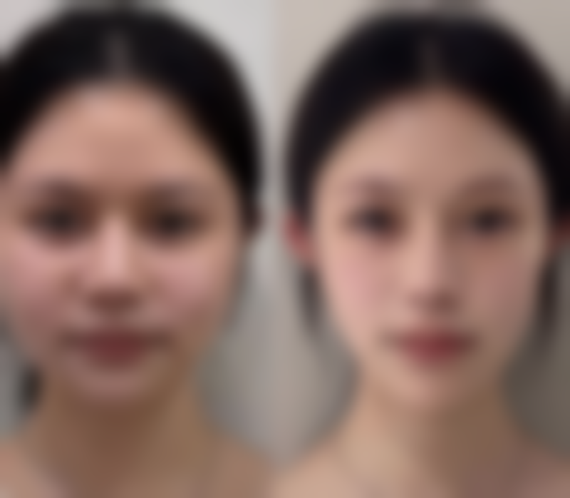 【福州华窈涣美整形美容医院患者口碑评价:】