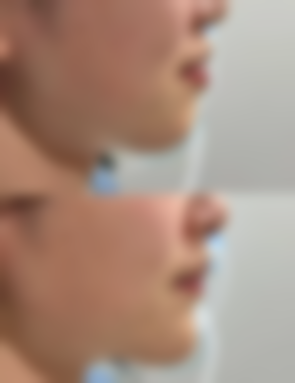 【朱艳琼医生怎么预约挂号？】