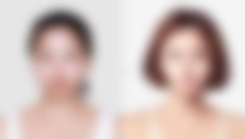 环切包皮多久可以碰水