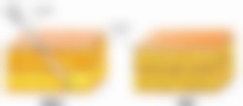 包皮环切术的其他注意事项