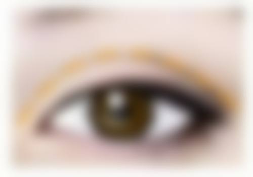 什么是激光除皱