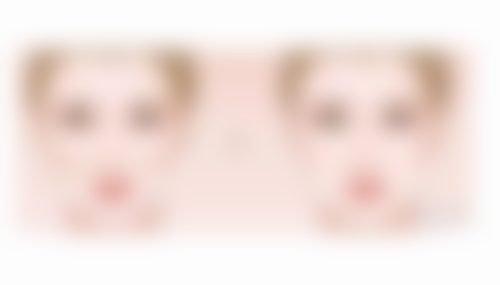 如何选择植发机构？