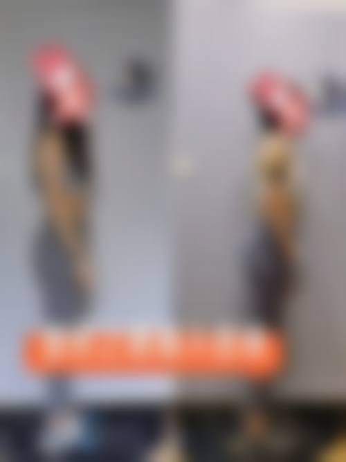 【刘忠梅医生擅长项目】