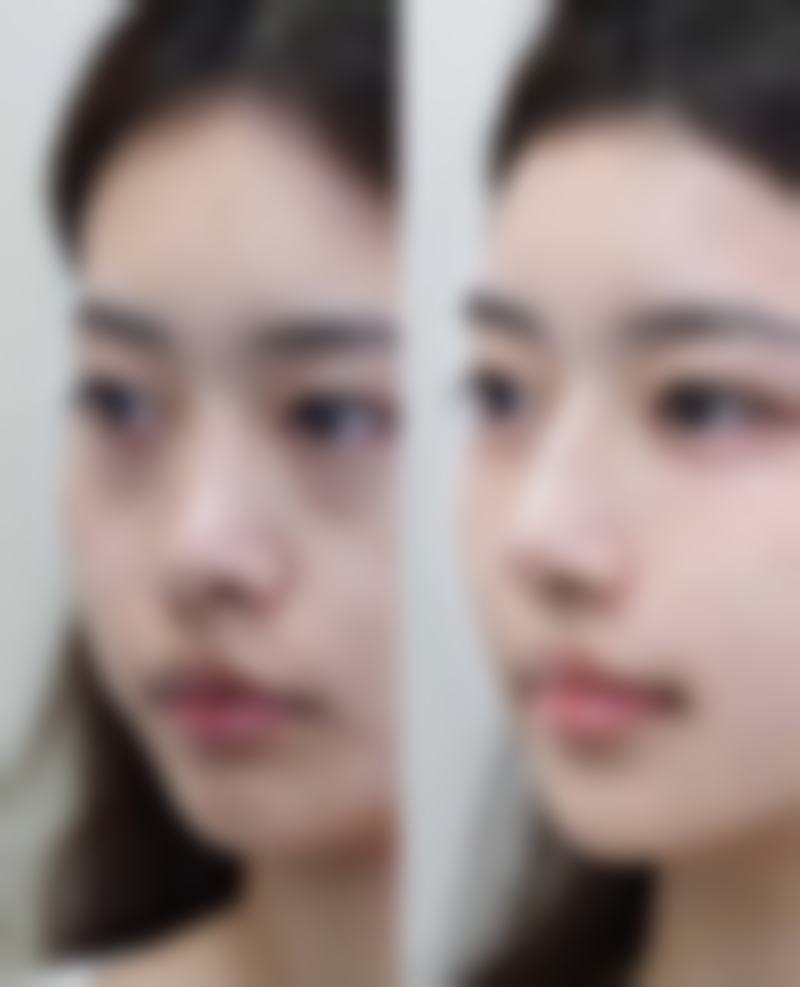 【罗登锋医生技术特点：】