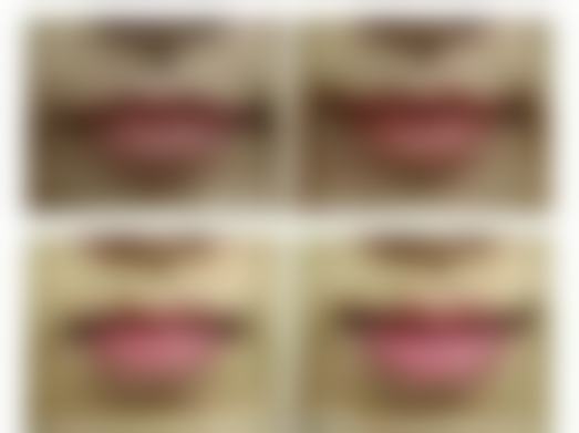 激光除皱的避坑指南