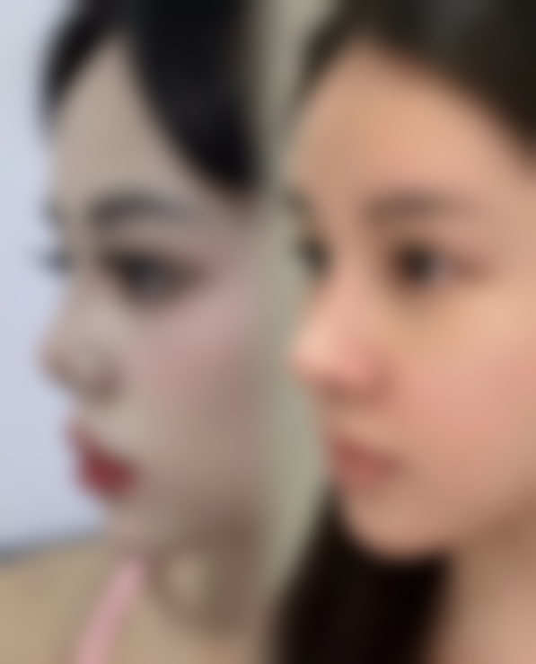 【潍坊华美整形医疗美容医院怎么预约挂号?】