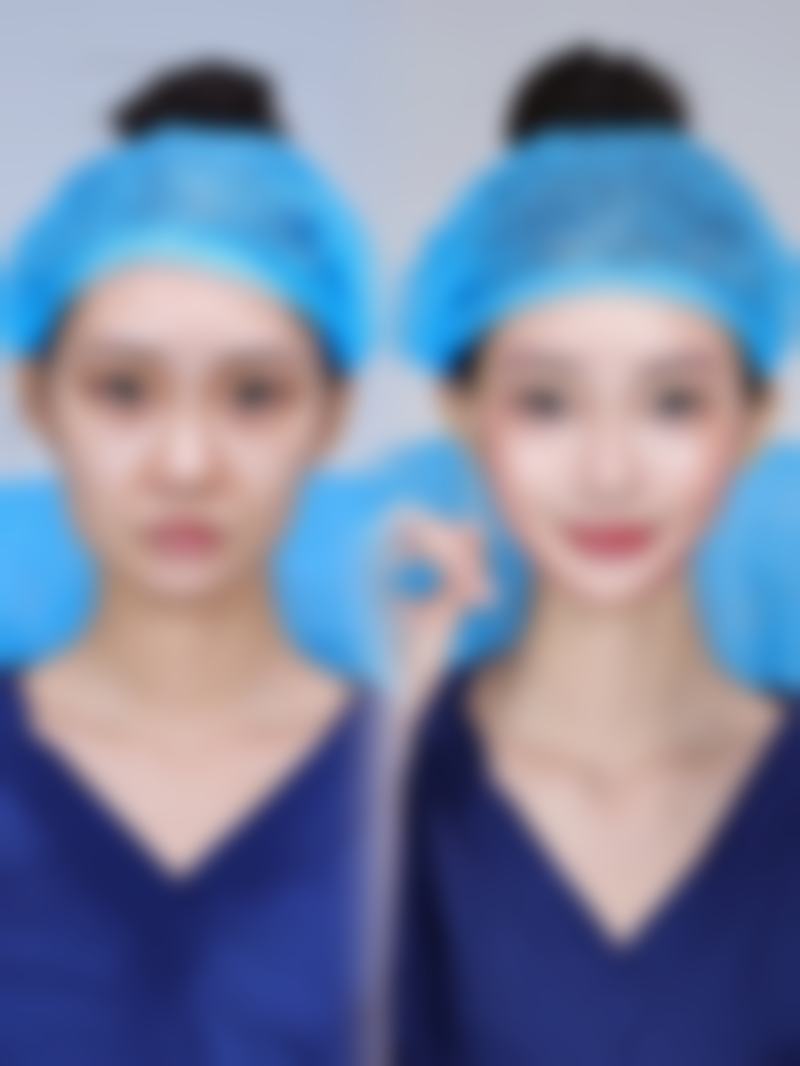 【刘忠梅医生怎么预约挂号？】