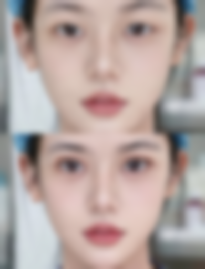 头发种植技术可靠吗安心吗？