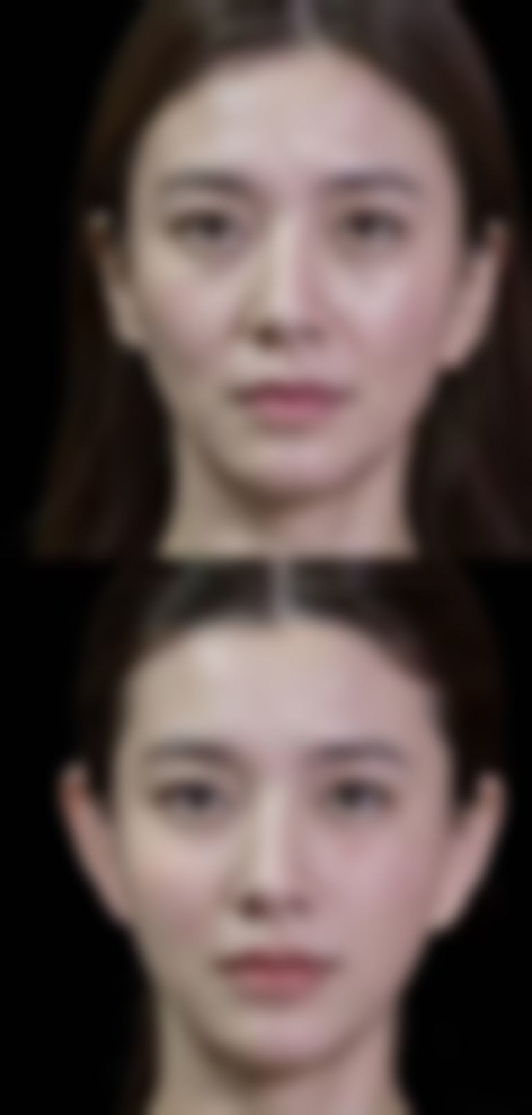 【宜春袁州艾莱芙医疗美容整形医院核心优势：】