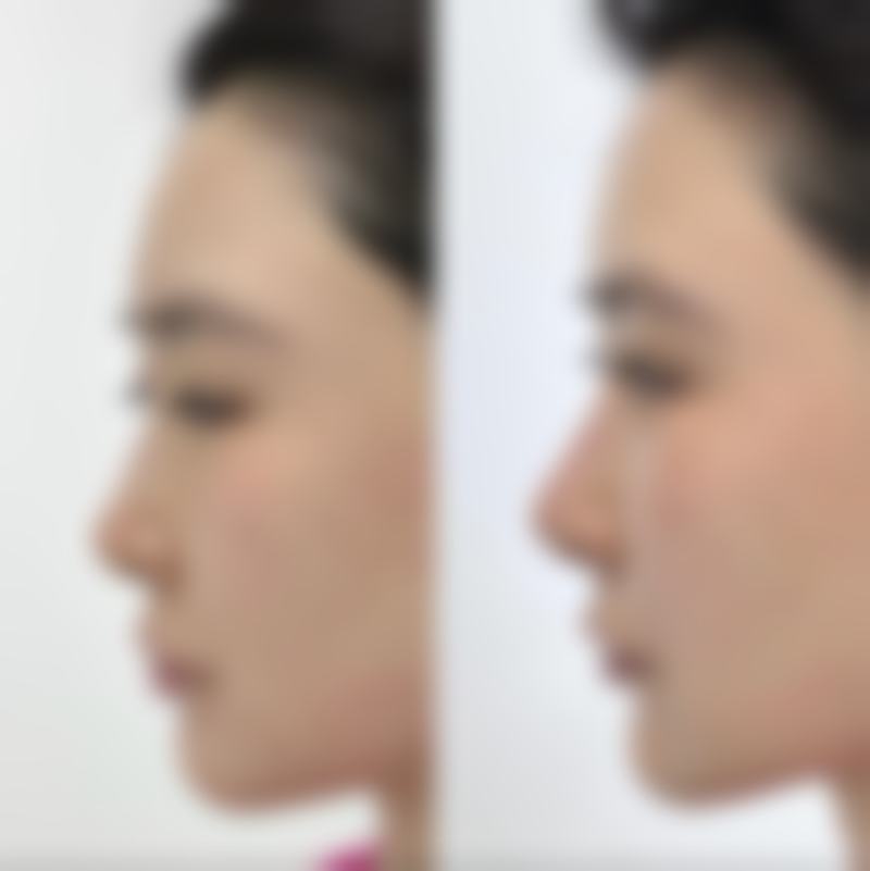 【银川市恒生医学美容诊所特色项目：】