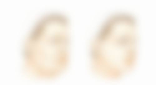 打除皱针能挺多长时间