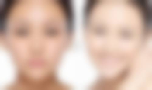 打完瘦脸针可以喝蜂蜜柚子茶吗