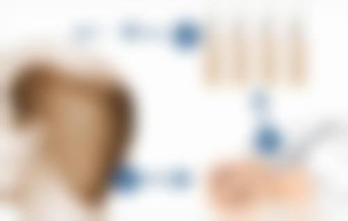 种植发际线前后对照图