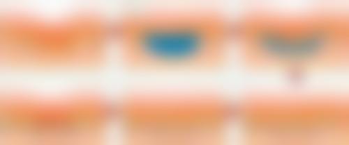 真的有种植头发吗？答案是肯定的！揭秘植发原理、效果及优势，让你告别脱发烦恼重获浓密秀发！ 