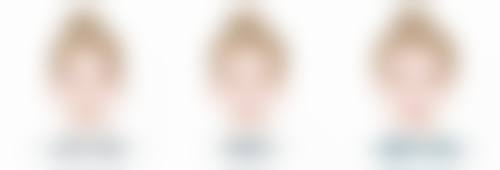 注射瘦脸针的注意事项