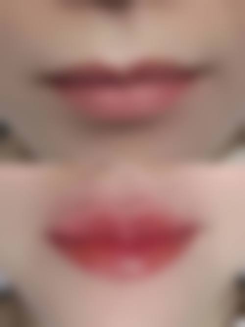 【深圳希思彩田医美医生团队：】