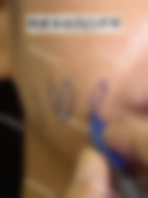 【罗登锋医生口碑怎么样？】