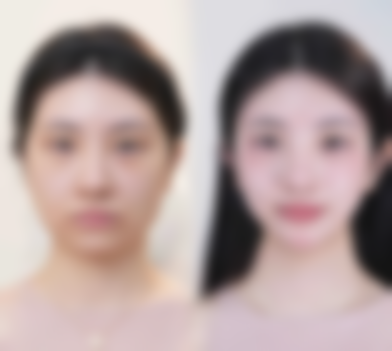 【厦门莫琳娜美容整形门诊部特色项目：】