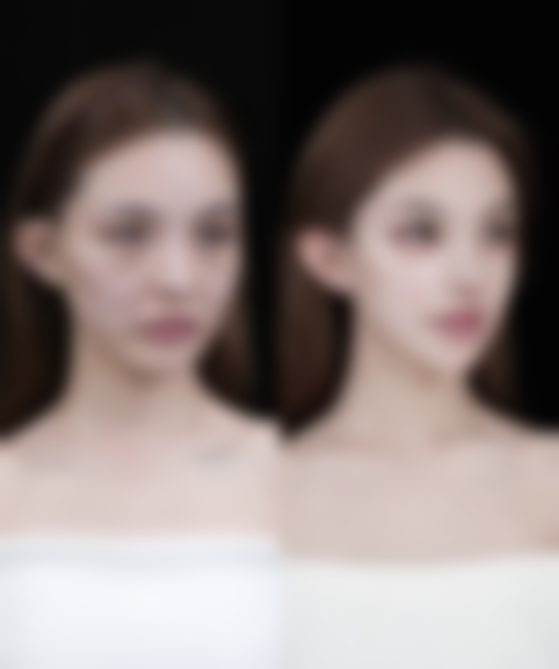 瘦脸针一边打一针有成效吗多少钱