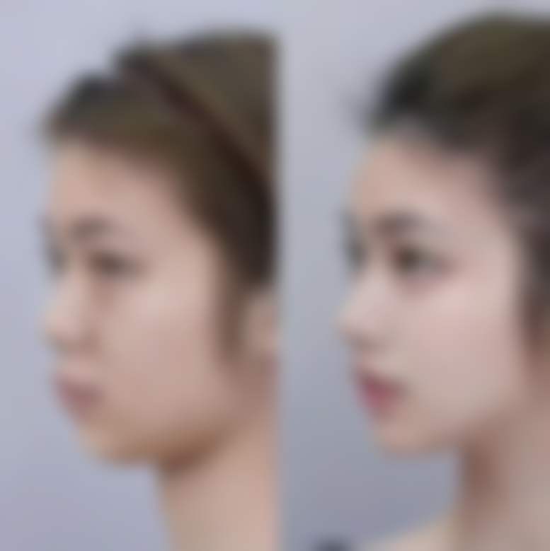 【莫海雁医生怎么预约挂号？】