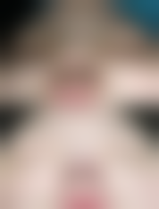 【刘忠梅医生技术特点：】