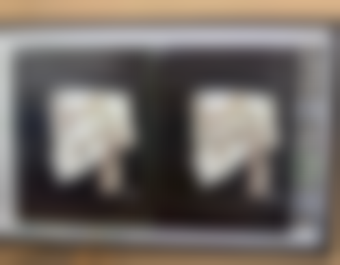 瘦脸针多少天开始有成效