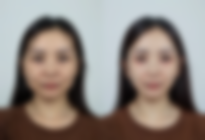 【烟台市莱阳中 心医院烧伤整形科怎么预约挂号?】