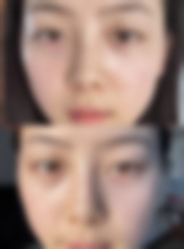 种植发际线有成效吗