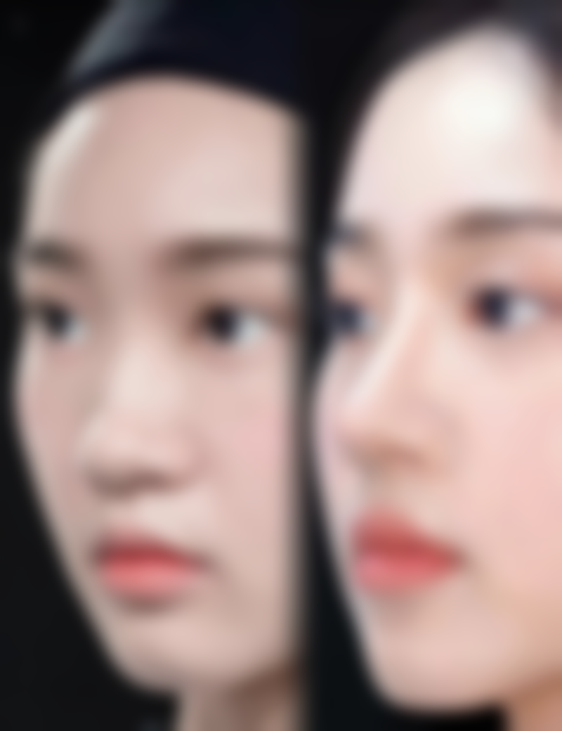 【深圳希思彩田医美地址：】