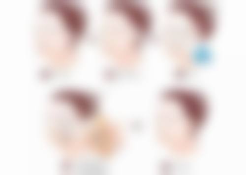 瘦脸针可以自己买不