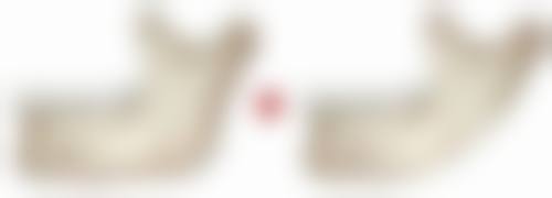 咬肌和耳朵的关系