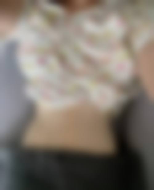 【北京四惠中医医院医美科是正规的吗？】