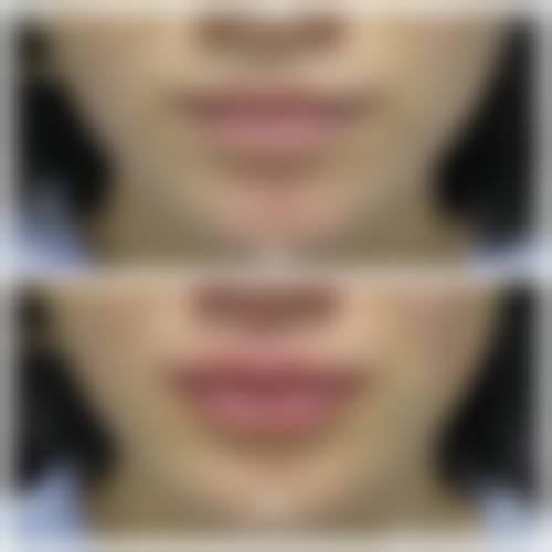 【新秀str·私密整形修复专科（南京旗舰店）患者口碑评价：】