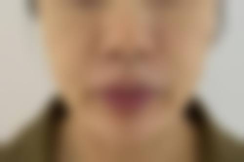 【韩国nplus整形外科参考价格表：】