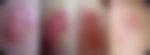 【潍坊慧星医疗美容诊所参考价格表：】