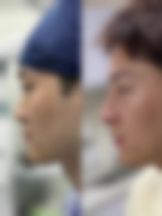 【韩国美自人整形外科怎么预约挂号?】