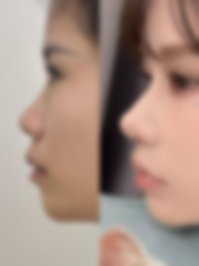 【仇树林医生技术特点：】