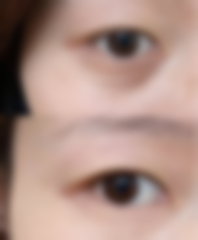 【秦皇岛晶京医疗美容诊所参考价格表：】