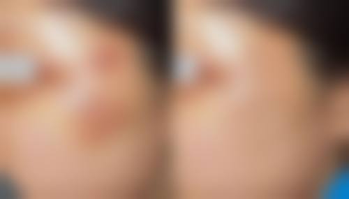 不同人群的注射次数差异