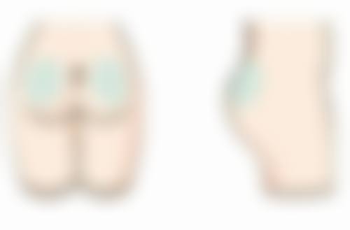 五、如何选择合适的瘦脸针治疗