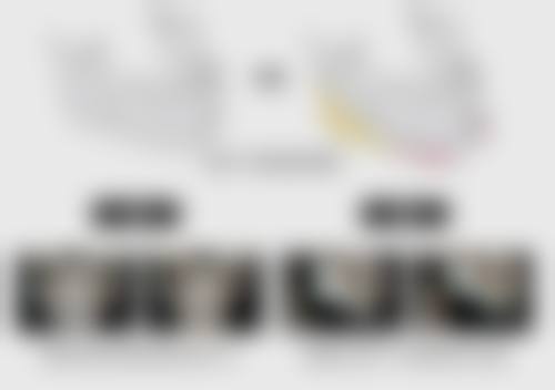 吃槟榔打瘦脸针有效吗？深度解析两者关联，揭秘3大关键因素决定瘦脸成效！ 