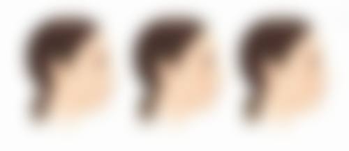 厚唇改薄正规医院