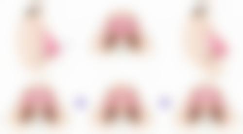 上半面部除皱大概要用多少单位的玻尿酸