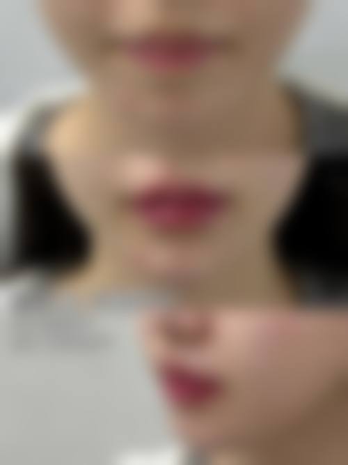 【广州金尚整形医院诊疗设备：】