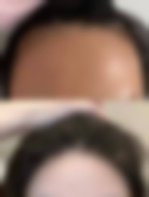 【刘明煌医生擅长项目】