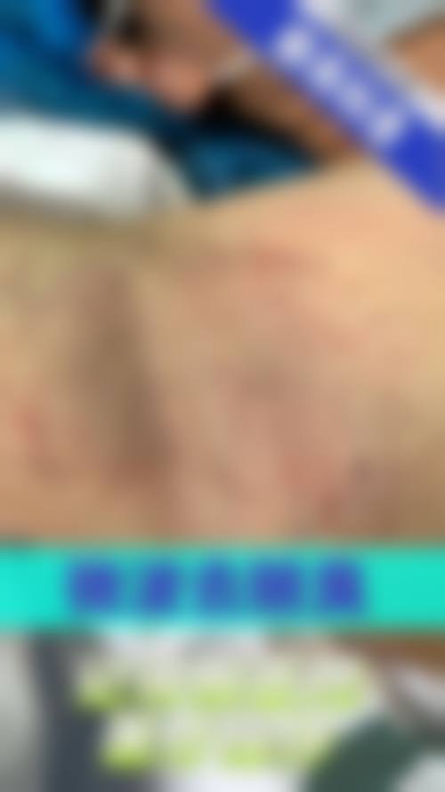 【刘明煌医生口碑】