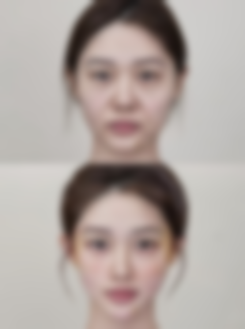 绿毒瘦脸针真假图片