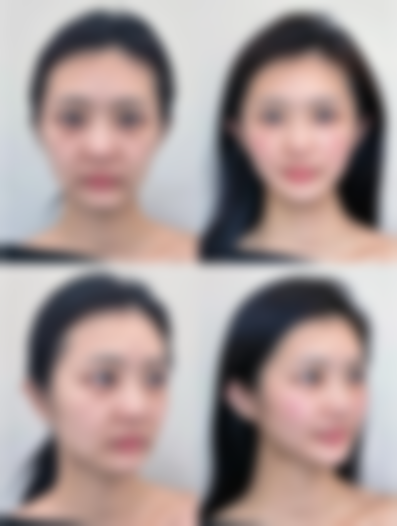 选择正规医疗机构和医生