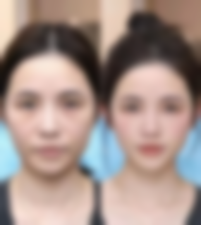 【THE SEROI整形外科（韩国德社罗伊整形外科）怎么预约挂号?】